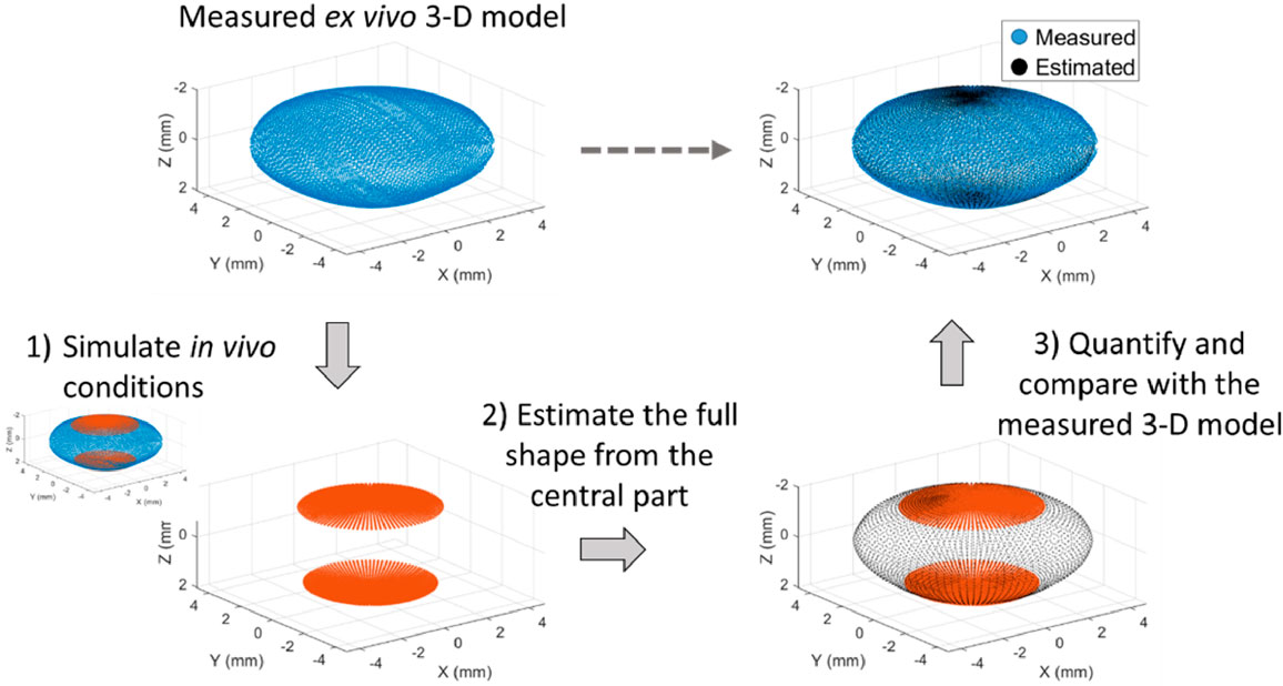 articulo-estimacion-cristalino-baja Gráfico en el que se ilustra como a partir de una parte del cristalino se puede calcular la forma del cristalino entero, y esto se compara con el cristalino real.