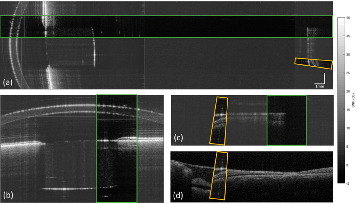 articulo-Optica-beam-scaner-PilarUriz-baja Diversas fotos internas del ojo en las que se recuadran las partes hechas con los distintos métodos, para que se note que unas son menos borrosas que otras