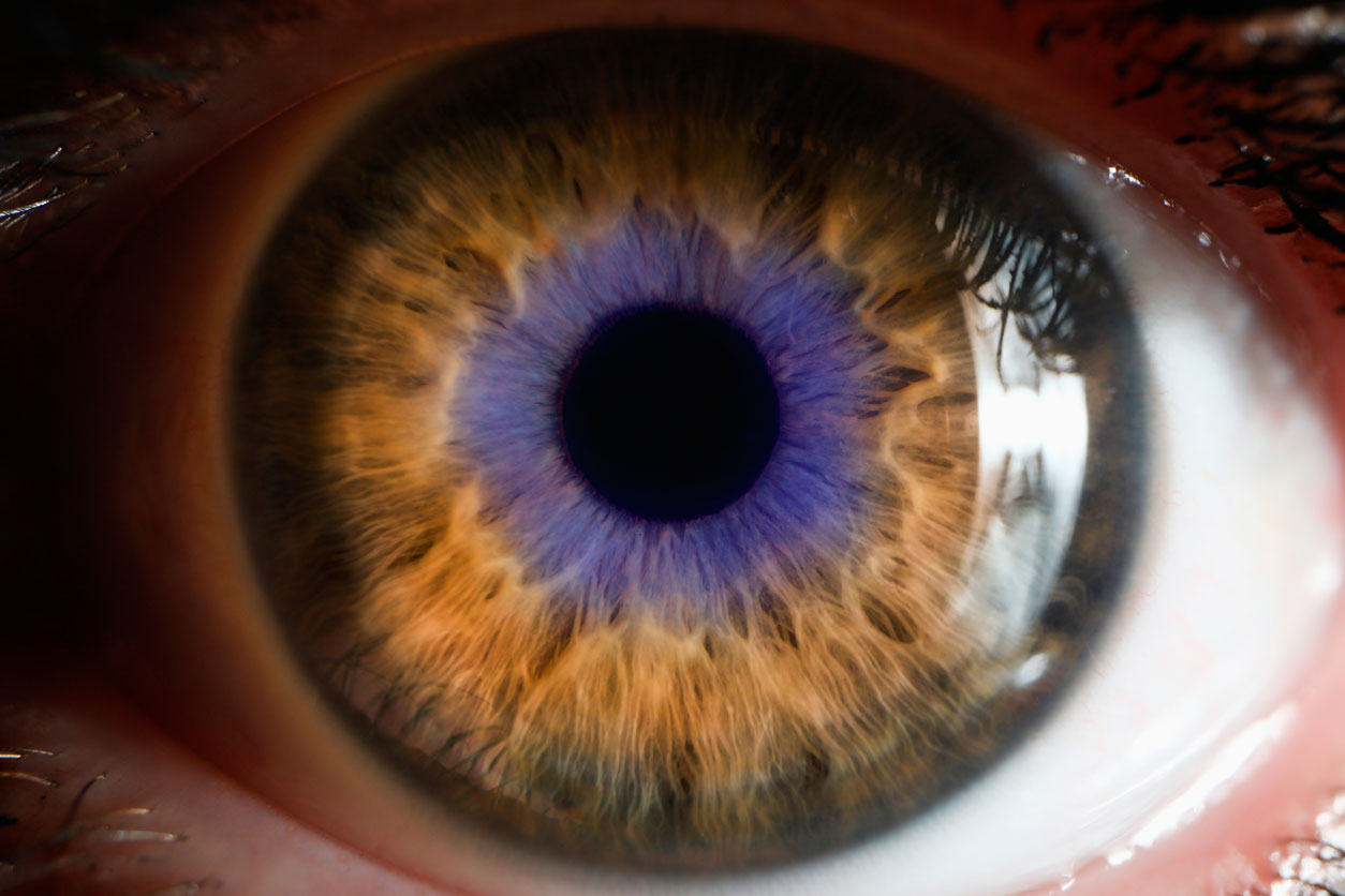 ojo-150852996_peque Very close view of a human eye with two colored irises