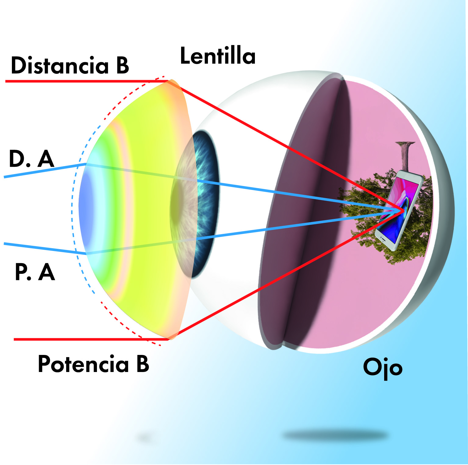 Simulación de lentes de contacto multifocales blandas diarias utilizando SimVis Gekko: desde la caracterización in vitro y computacional hasta la validación clínica.